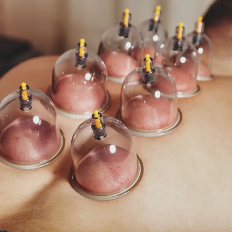 Massage aux ventouses à Cannes